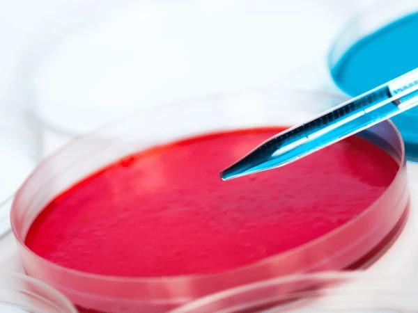 Close up of agar plates which represent urine culture, one of the ways to diagnose UTI in dogs and UTI in cats