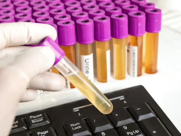 Laboratory test tubes representing diagnostic tests that influence emergency vet costs