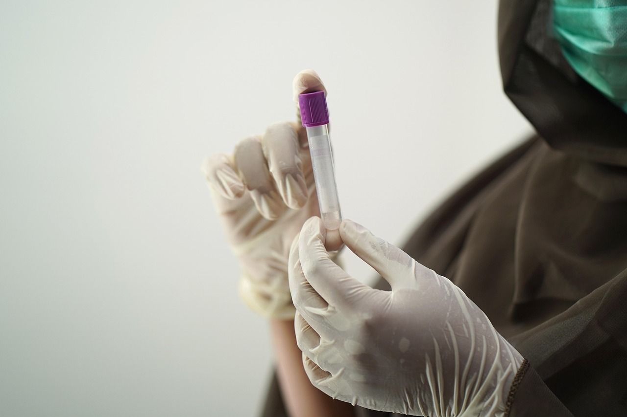 Lab technician in surgical gloves handling a blood sample tube