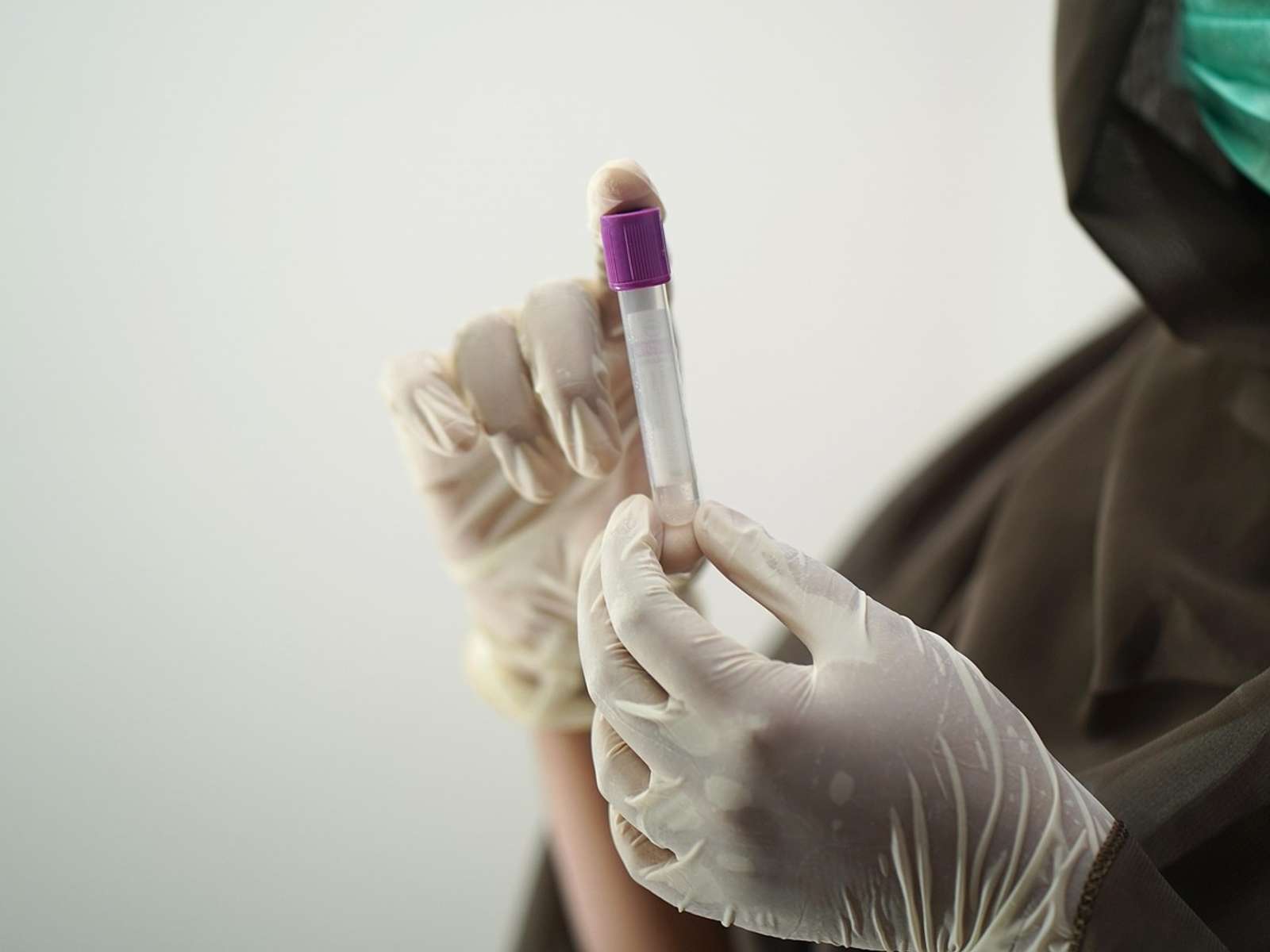 Lab technician in surgical gloves handling a blood sample tube