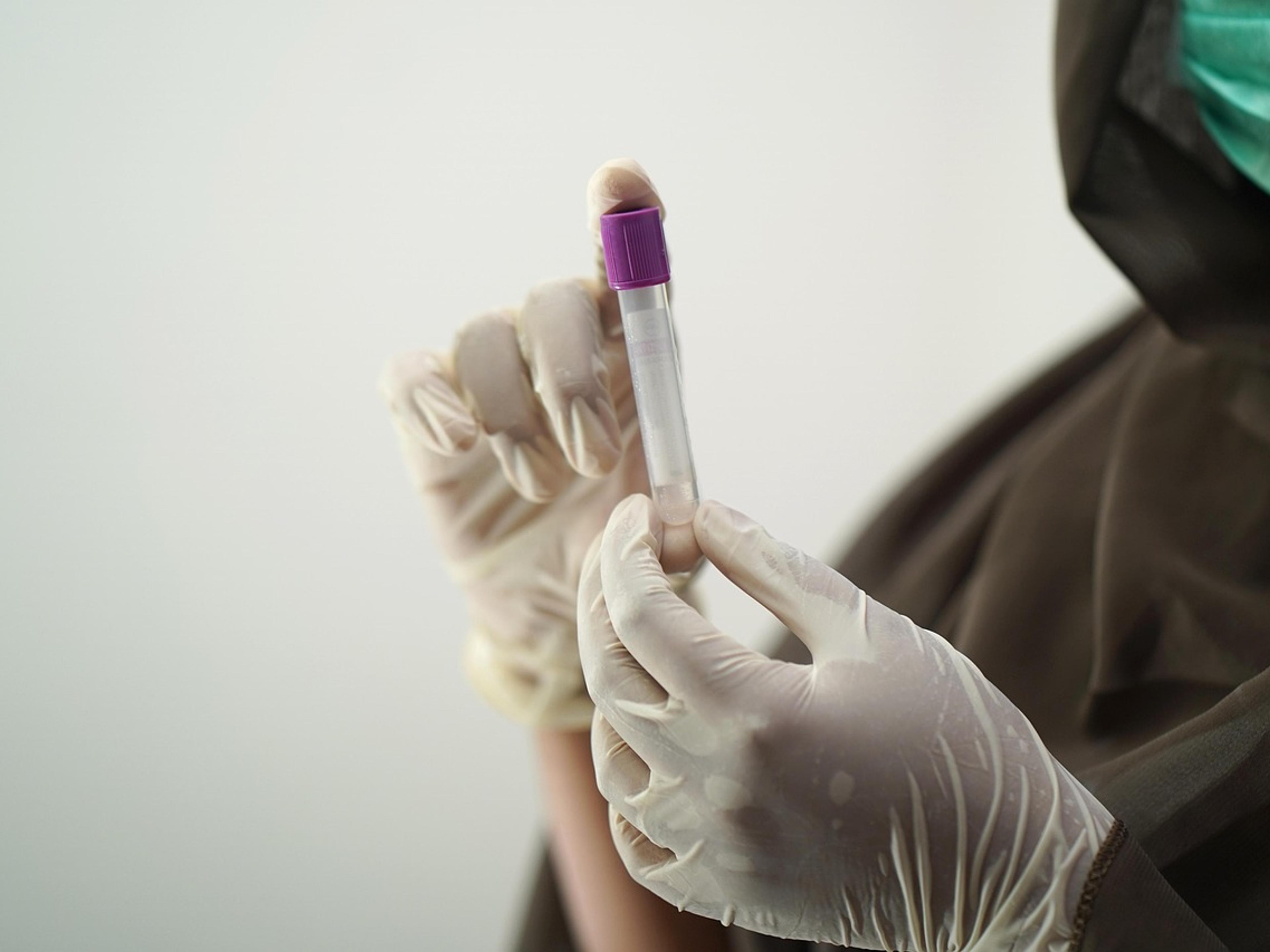 Lab technician in surgical gloves handling a blood sample tube