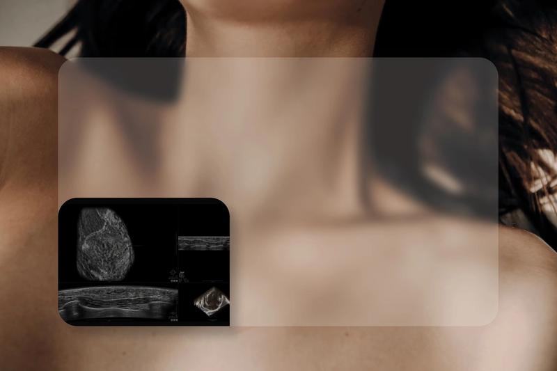 Automated breast ultrasound (ABUS) scan illustration