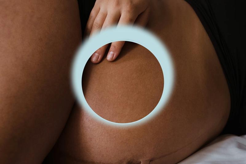 Woman receiving a breast ultrasound while pregnant or breastfeeding.