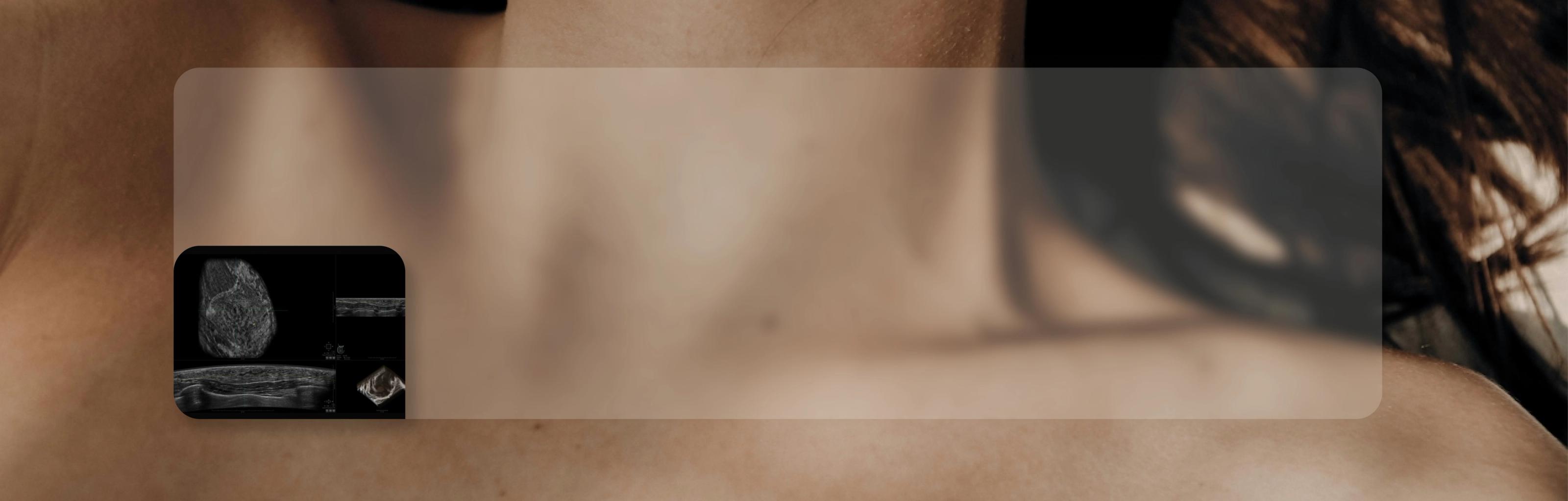 Automated breast ultrasound (ABUS) scan illustration