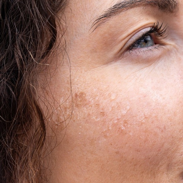 Image des réseaux sociaux : Morgane Atanasiu