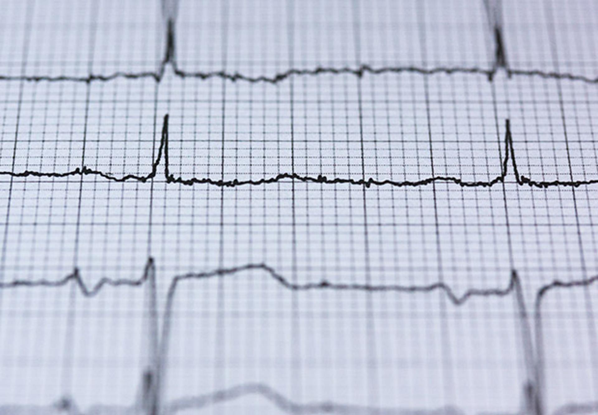 Checking the Pulse on the Millennials