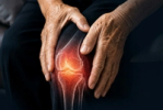 Advanced Total Knee Replacement Package