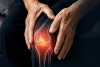 Advanced Total Knee Replacement Package