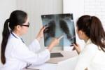 Low Radiation CT Lung Screening