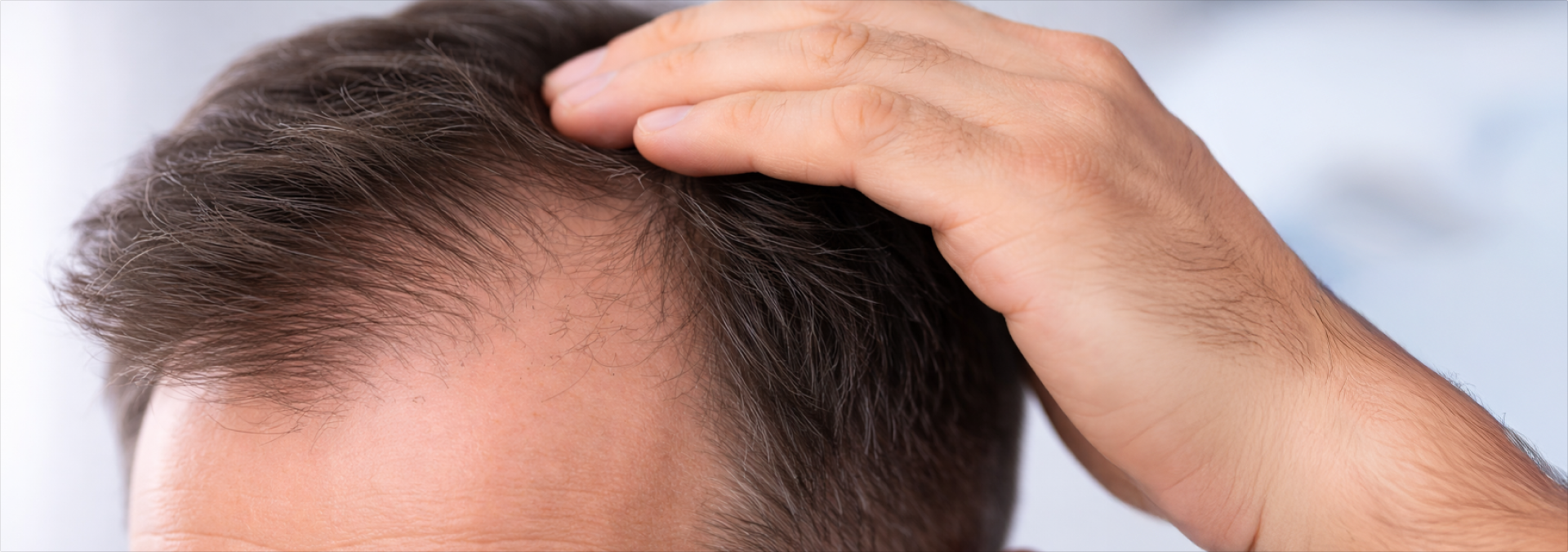 Hair Loss Medications Can Affect Sexual Function