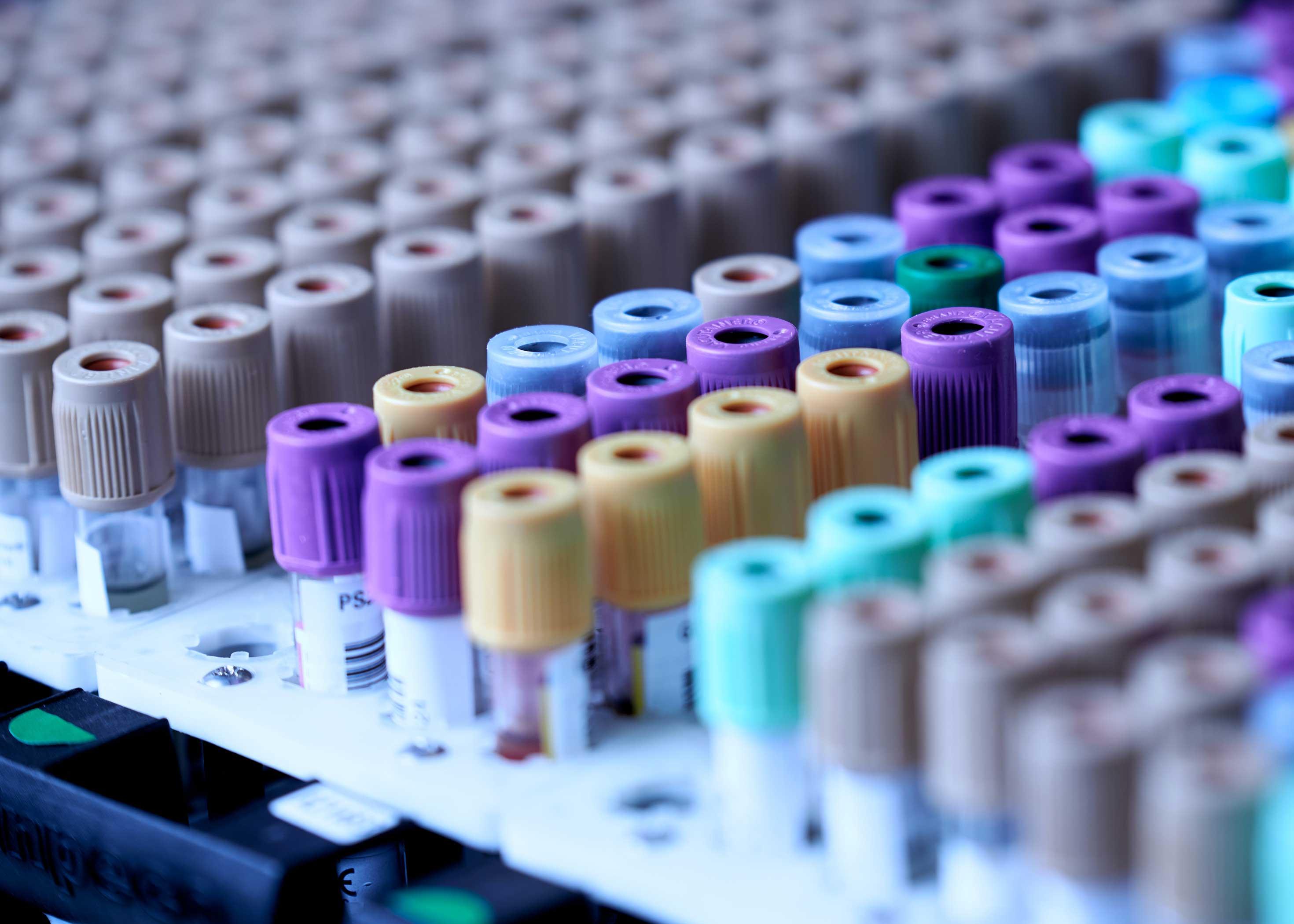 Transnetyx Expands Into Europe With Speed and Flexibility