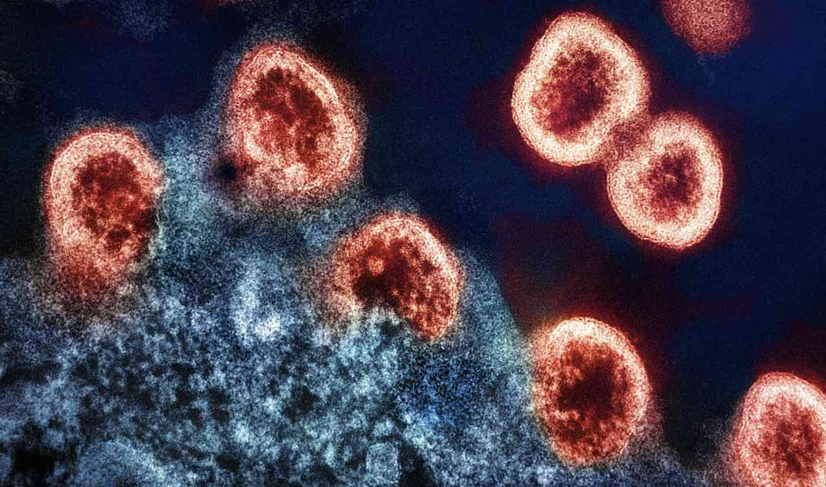 HIV cells using CRISPR-Cas gene editing