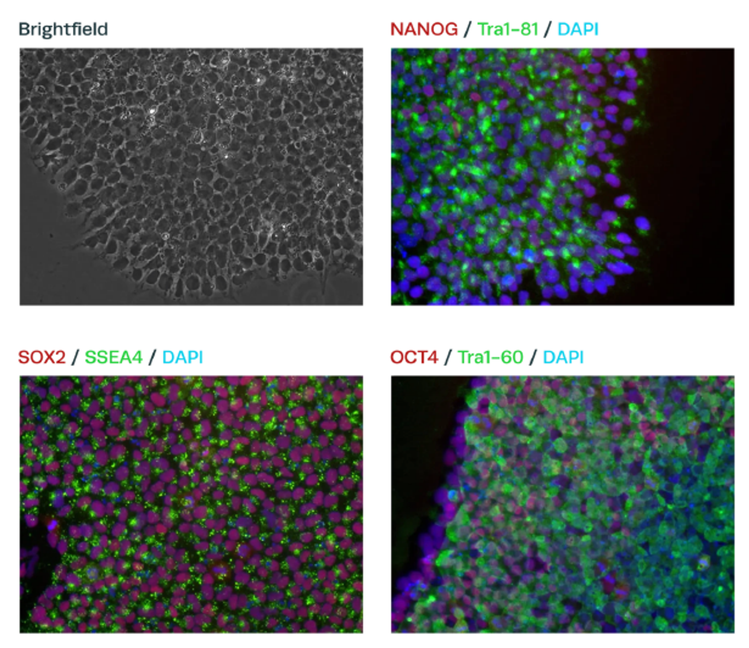 iPS cells assessed for standard pluripotency markers