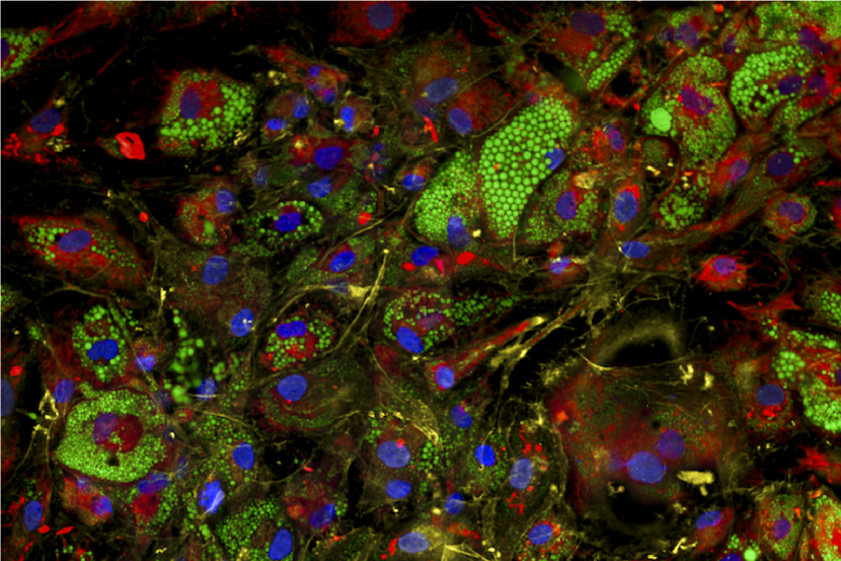 Cellular profiling tools for disease-relevant phenotypes