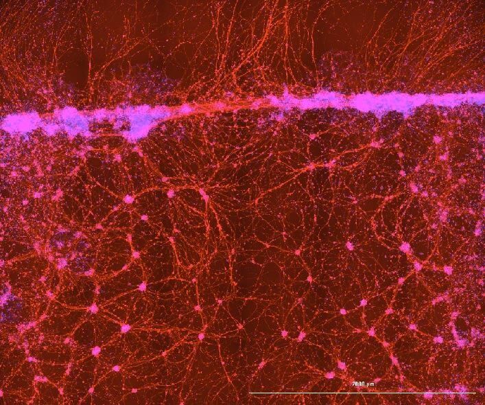 CRISPR-edited nerve cells