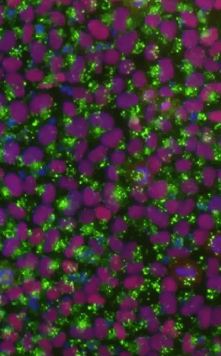 Human iPSC colony under fluorescence