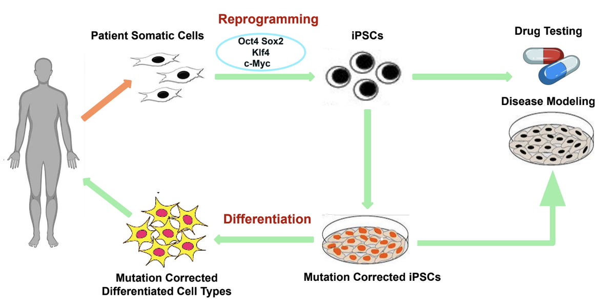 iPSC-based disease modeling for human diseases