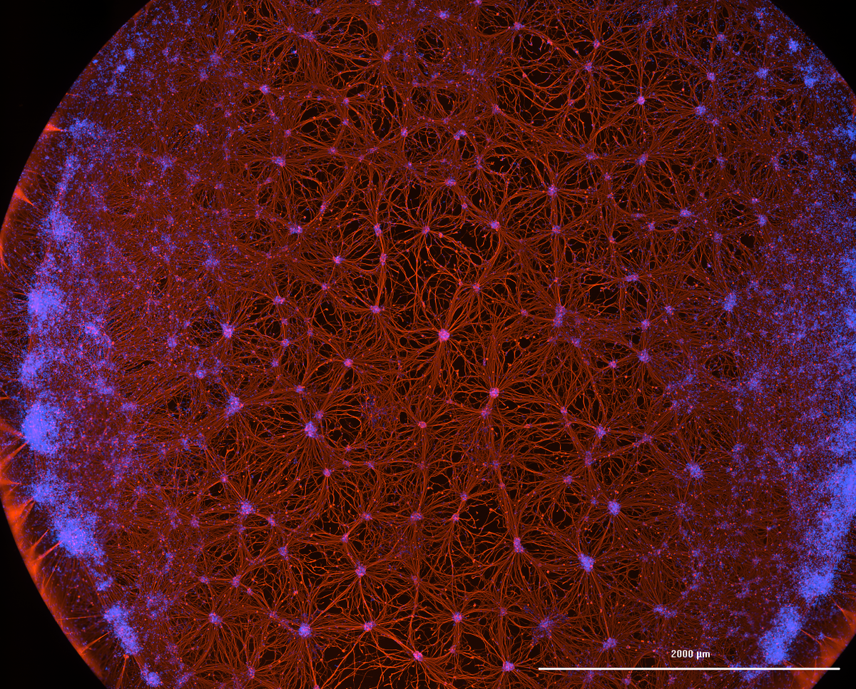 CRISPR-edited nerve cells