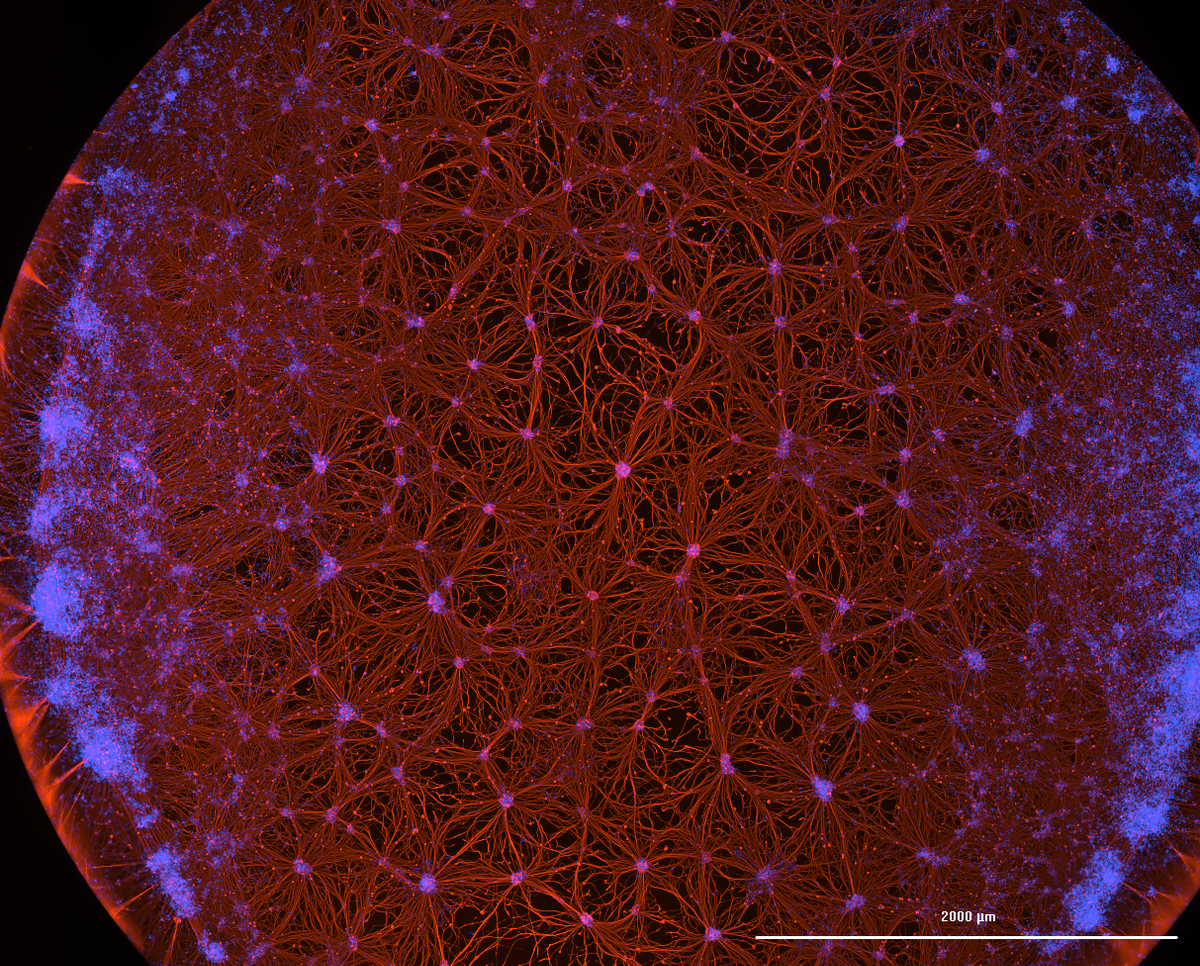 CRISPR-edited nerve cells