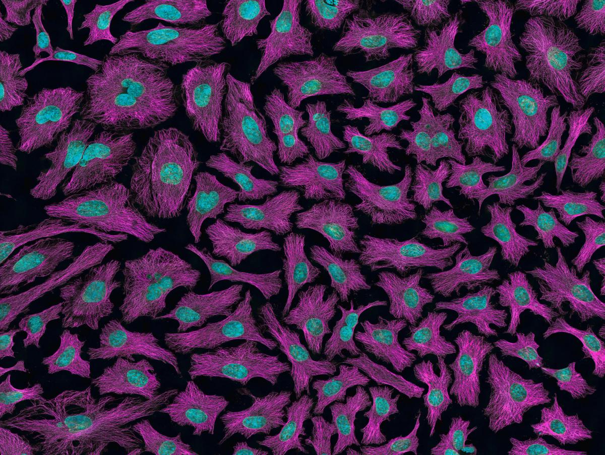Not All CRISPR Kits Are Created Equal: How to Choose the Right Knockout Kit