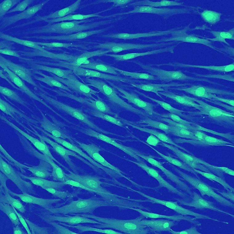 Fluorescent knockout immortalized cell line