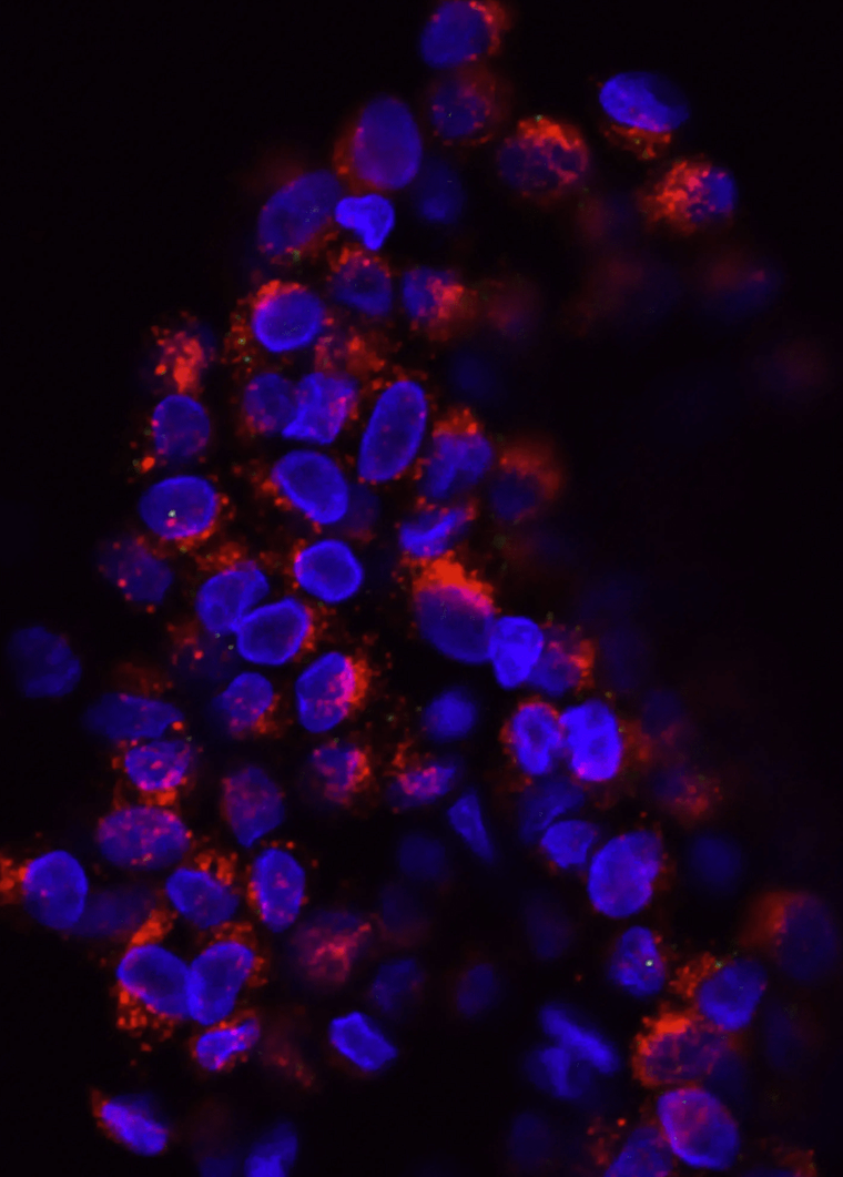 Human iPSC colony under fluorescence