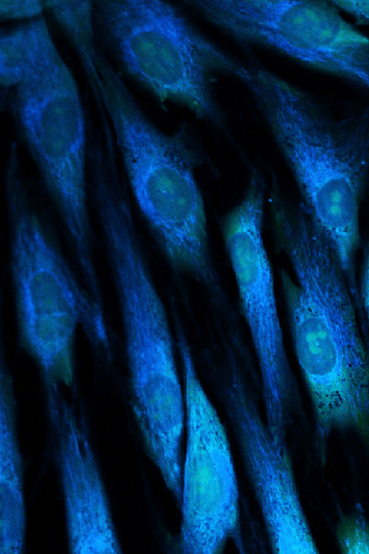 Primary fibroblasts