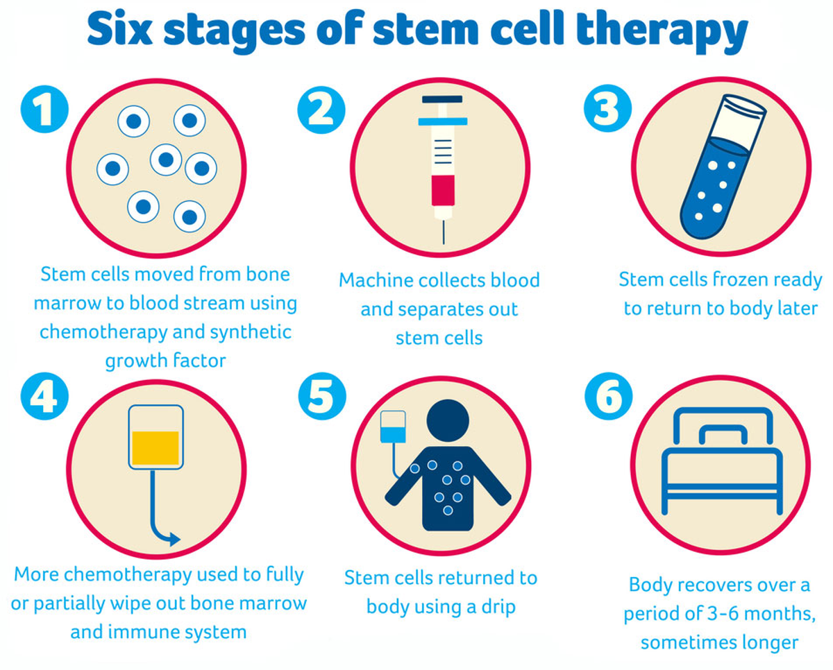 Six stages of stem cell therapy