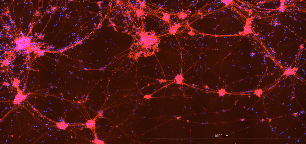 CRISPR-edited nerve cell microscopy