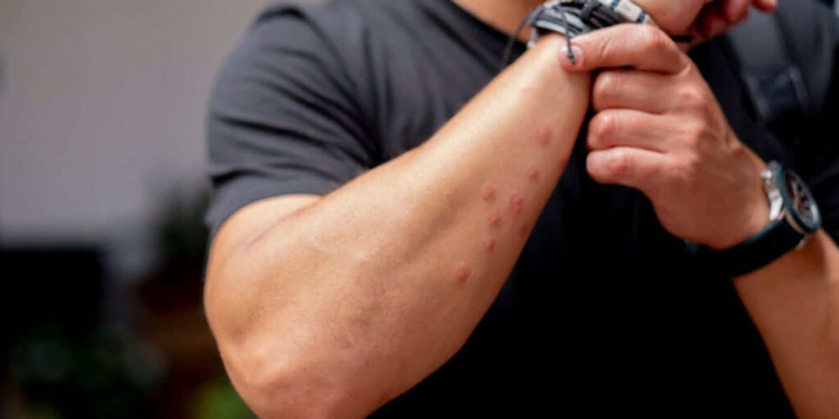 Early Signs Bed Bugs Are Spreading
