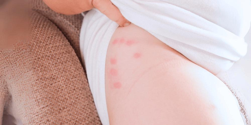 3-Common-Signs-of-Bed-Bug-Activity