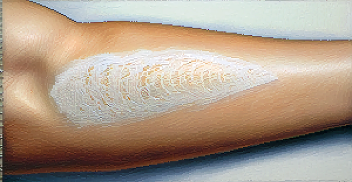 A detailed view of a transdermal patch on a person's forearm, focusing on the texture and adhesive layer of the patch.