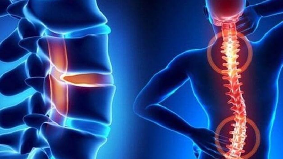 Hết Đau Lưng và Cổ Nhờ Yoga Trị Liệu