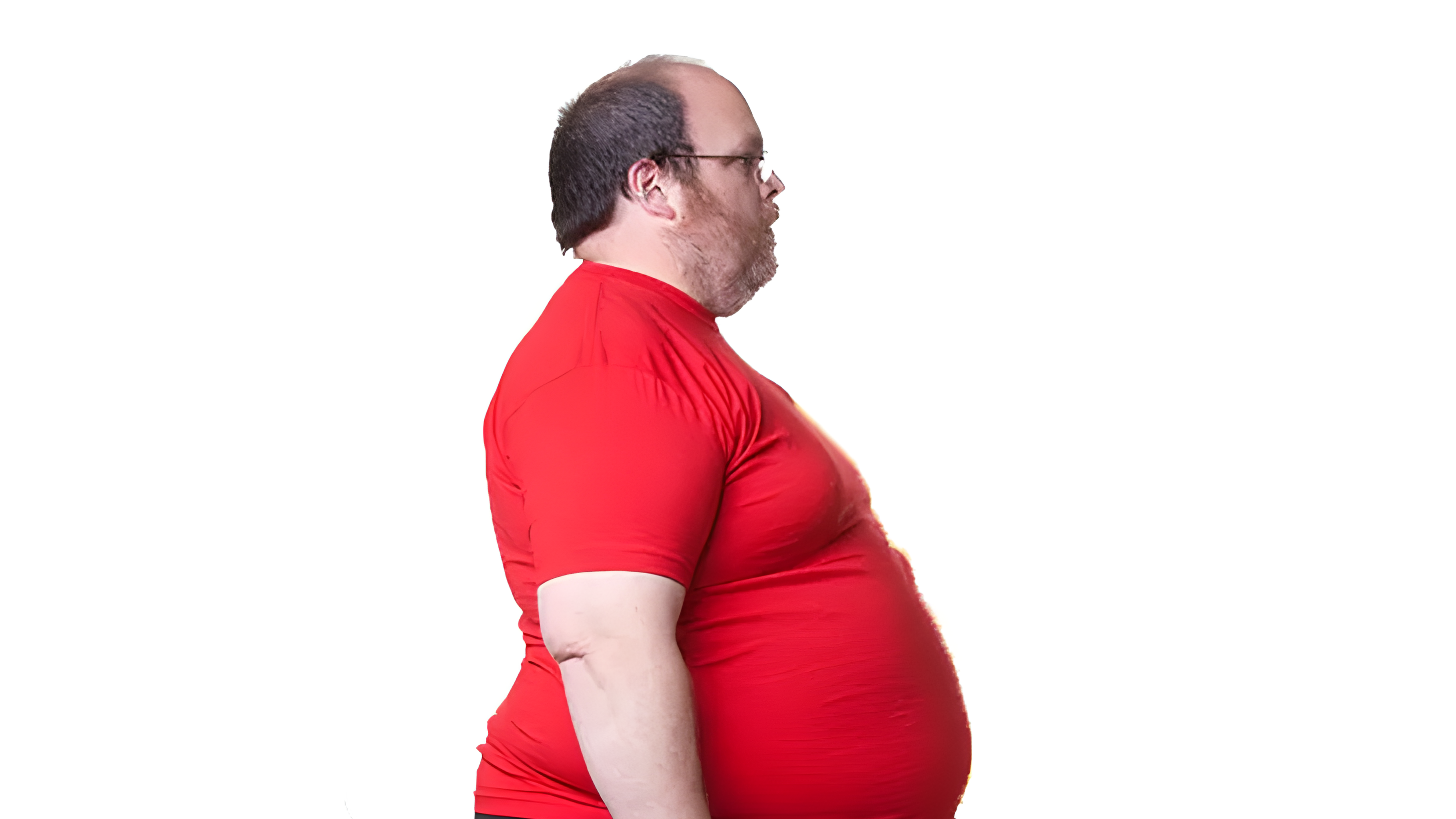 Bariatric surgery operation by Dr. Tagore