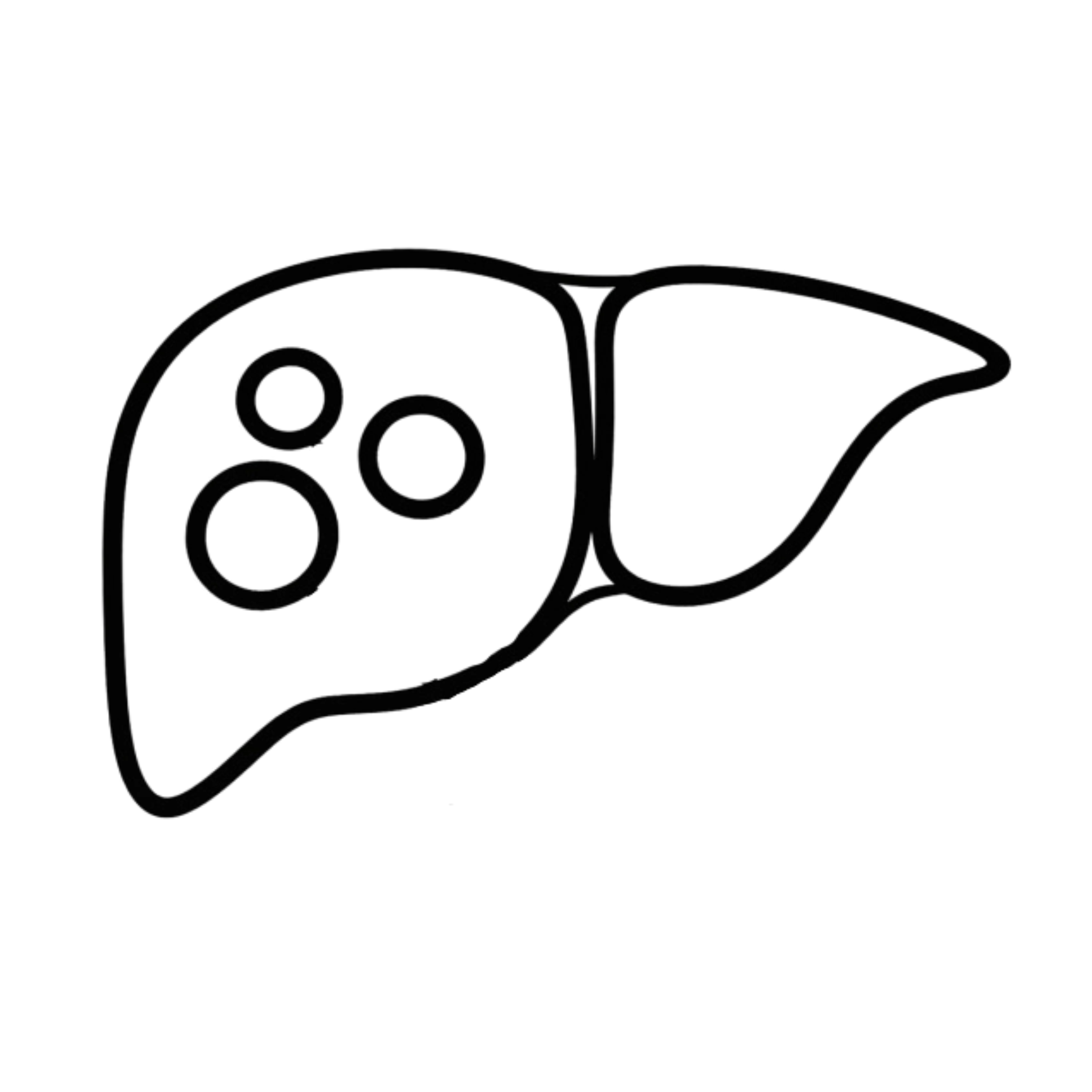 Liver Cysts