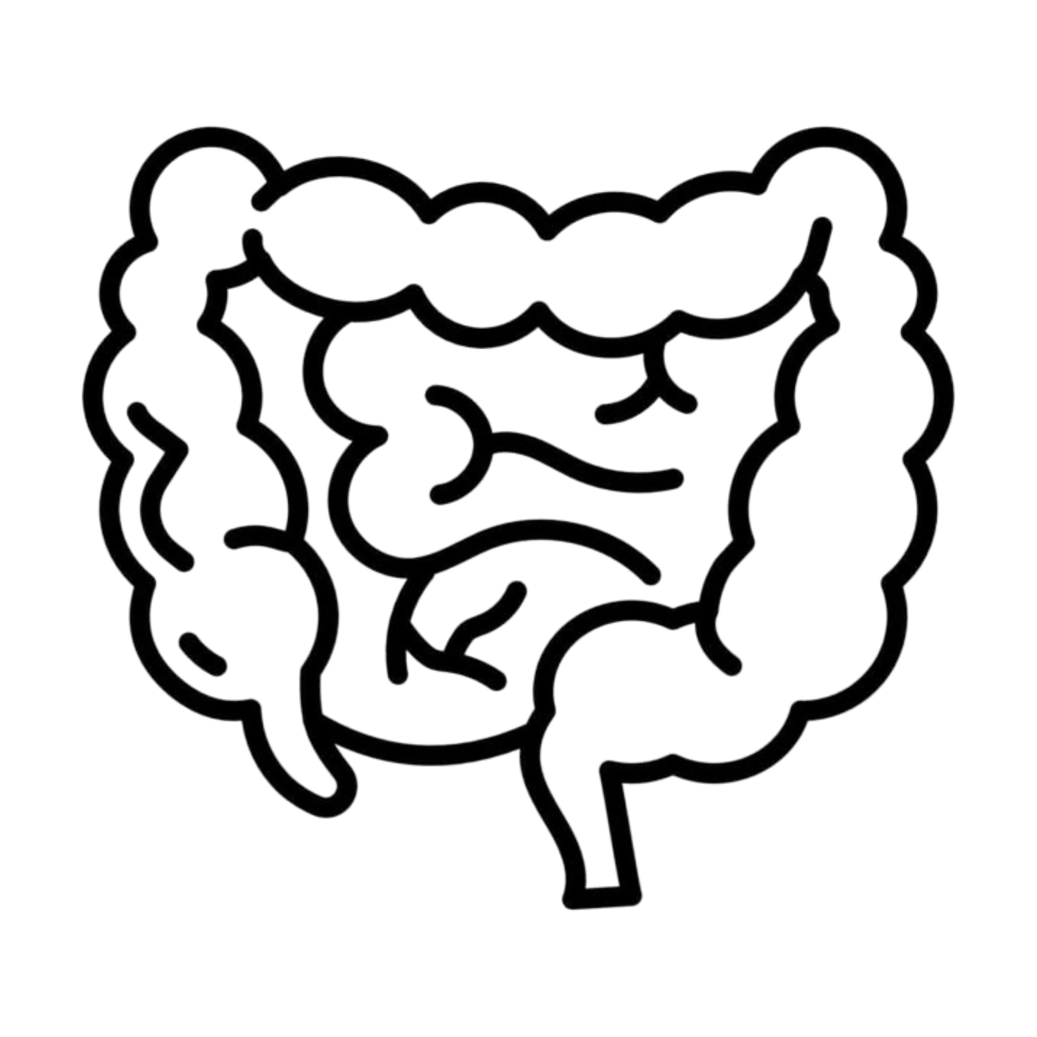 Abdominal Tuberculosis