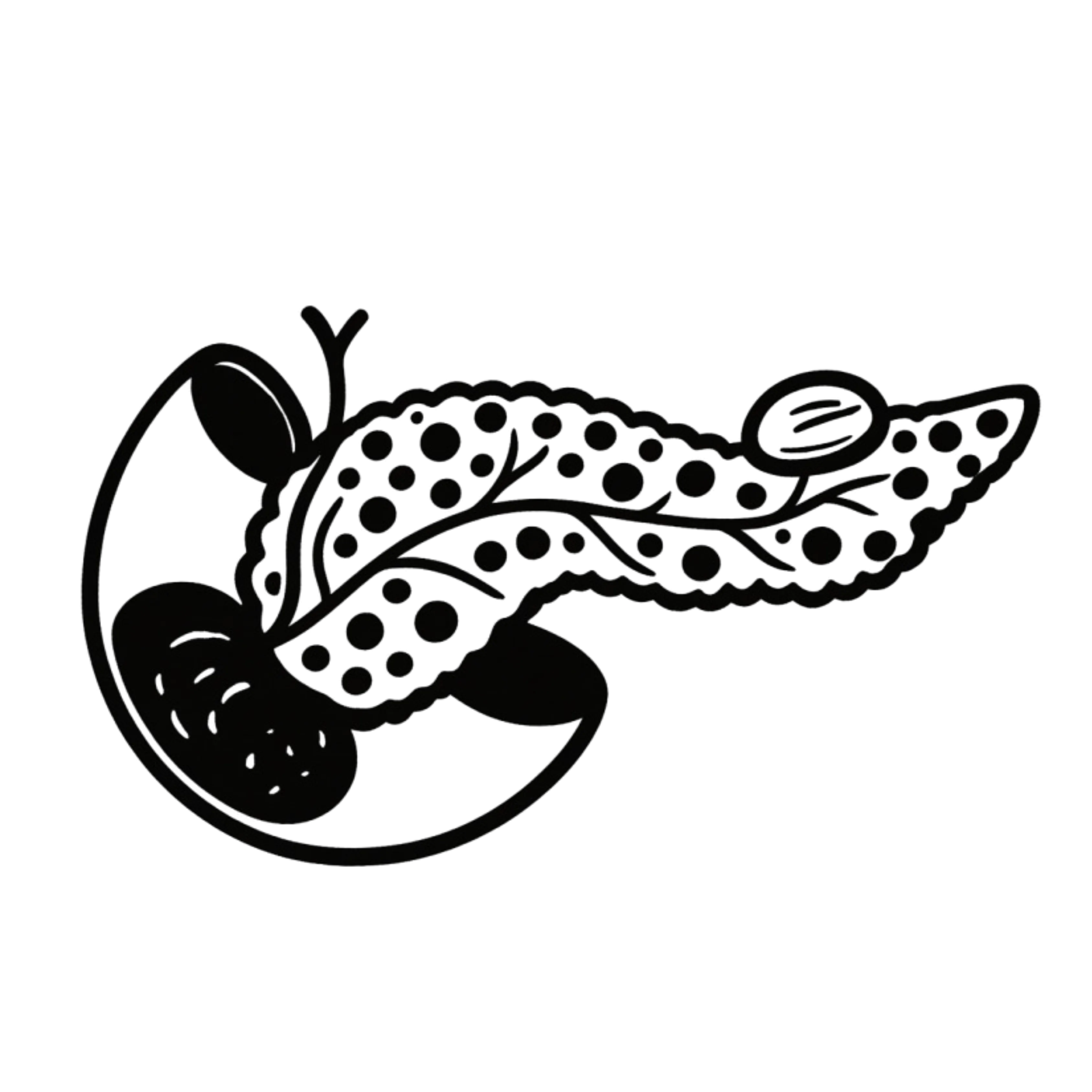 Pancreatic Pseudocysts