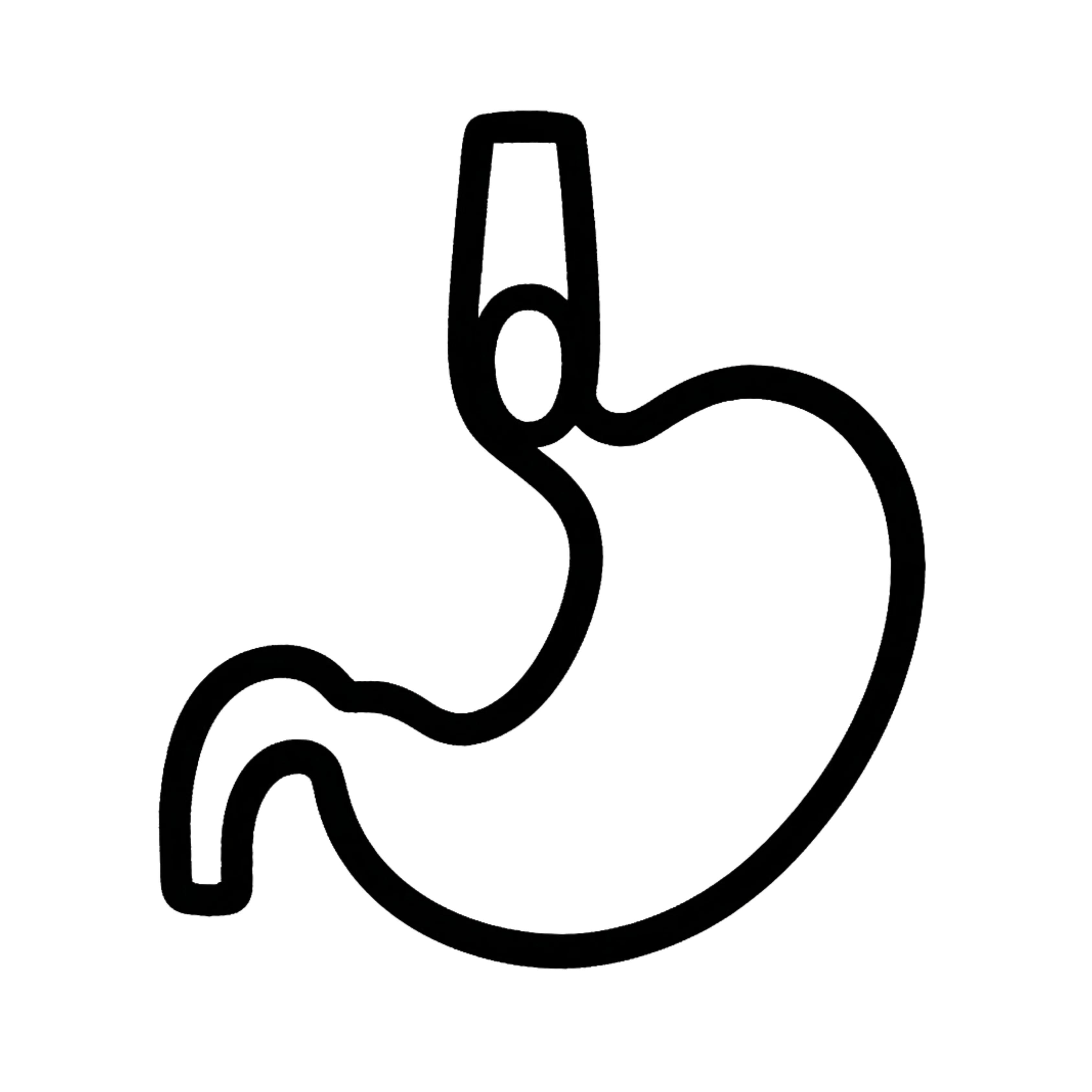 Achalasia Cardia