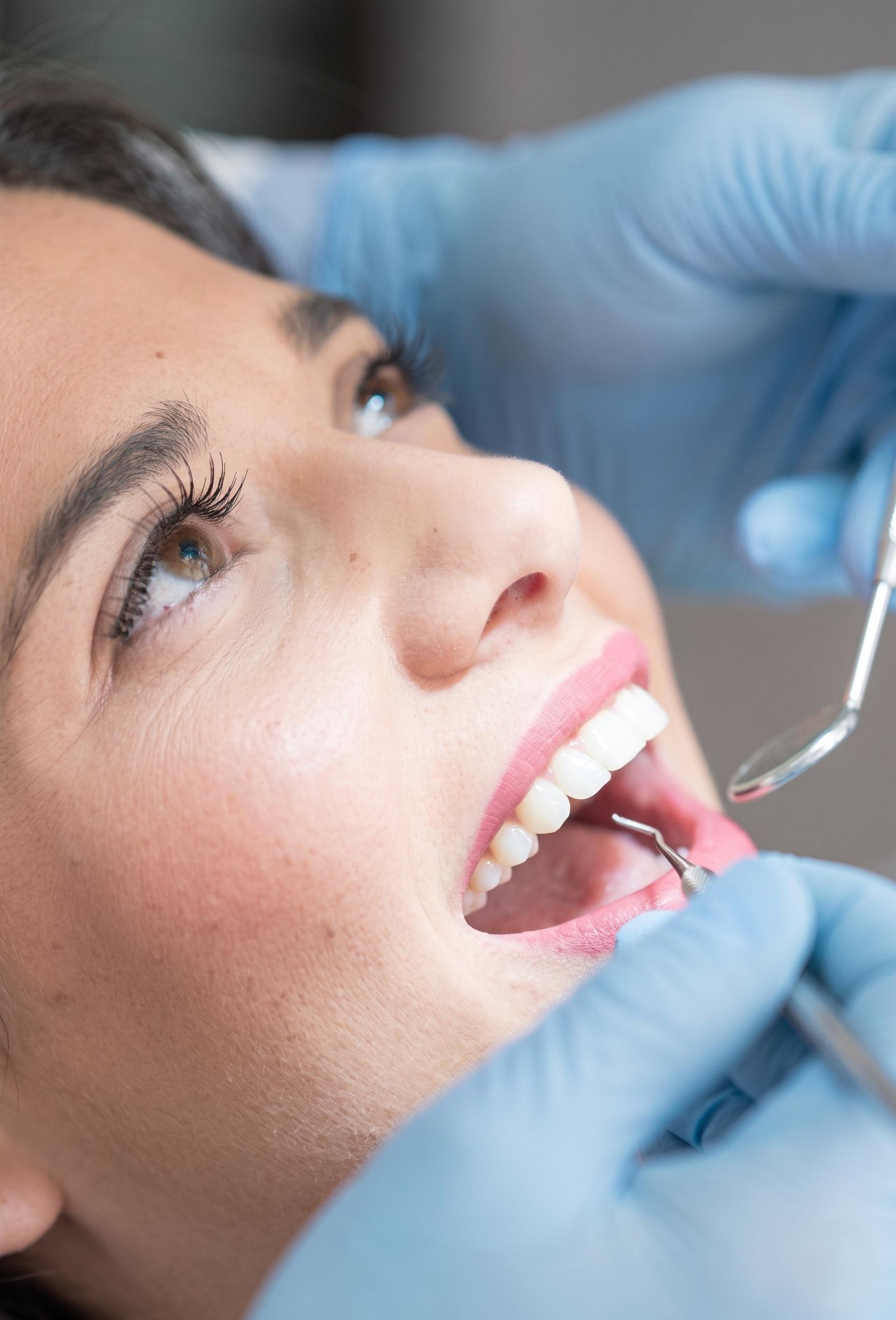 Close-up of a patient smiling during a dental exam