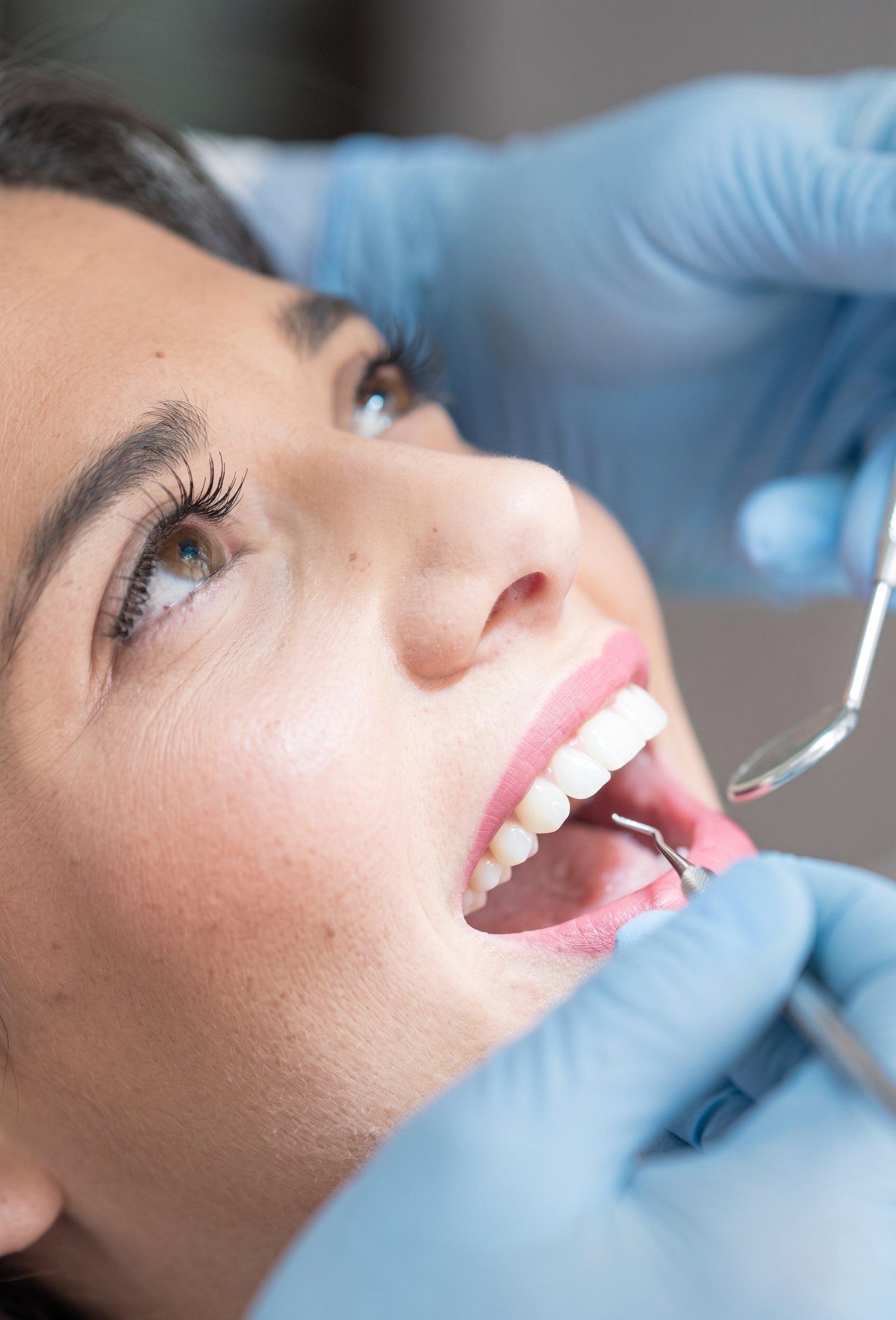 Close-up of a patient smiling during a dental exam