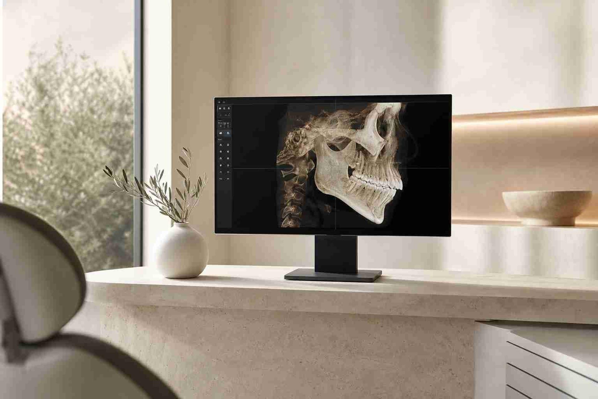 3D dental scan of a skull on a monitor