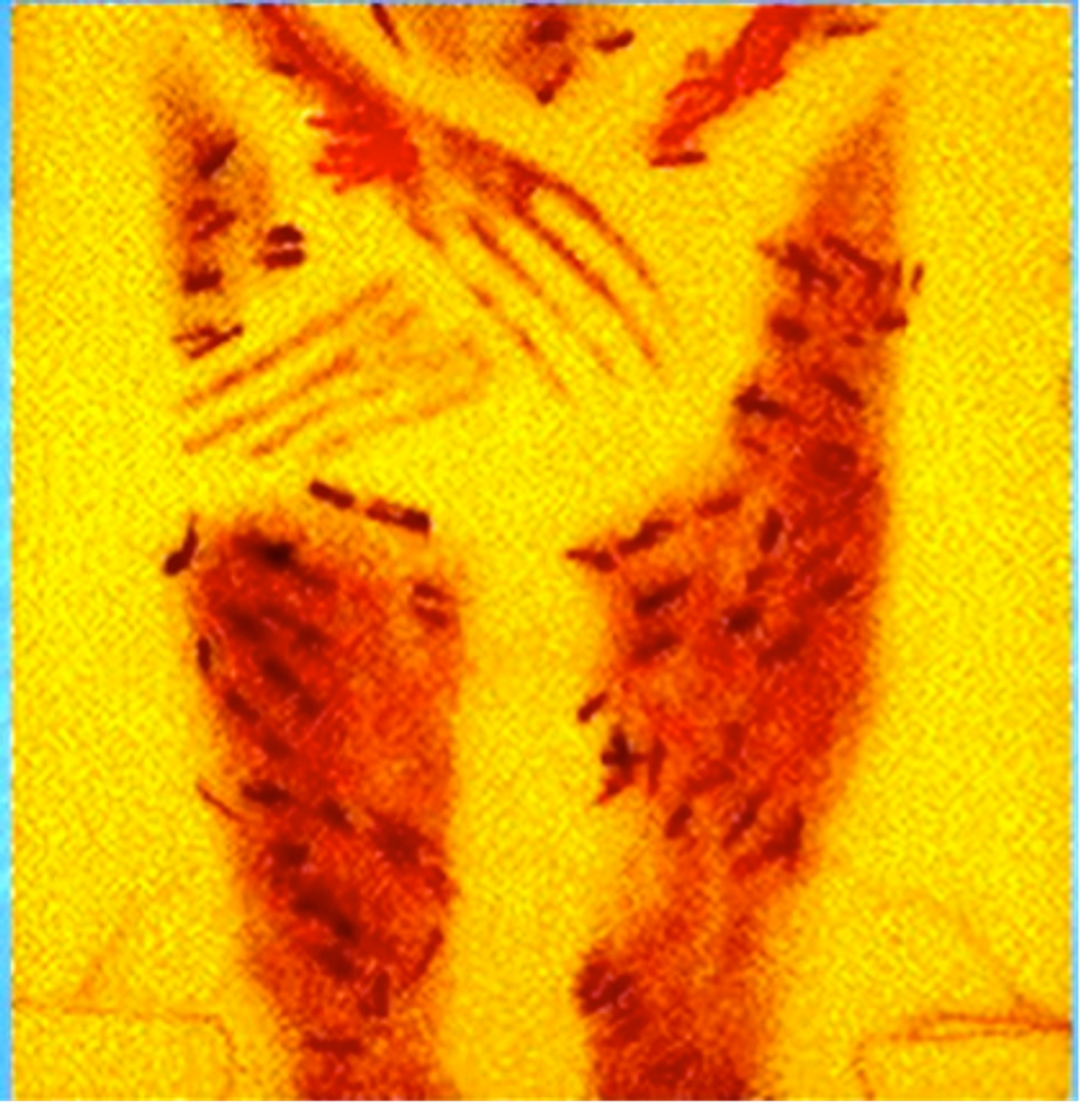 pic1-1