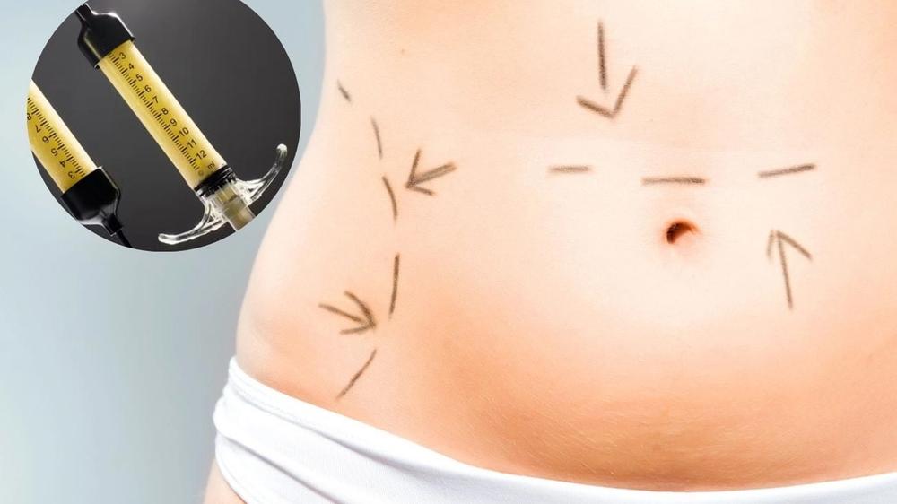 ¡De no creer! Usan grasa de difuntos para tratamientos de belleza en EEUU
