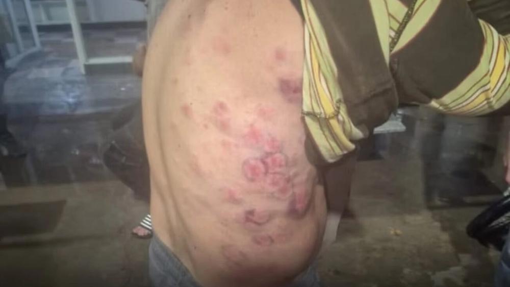 Fenómeno meteorológico extremo causa daños y lesiones en la Ruta 9, provincia de Santa Fe