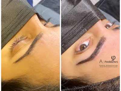 brow-combo-image