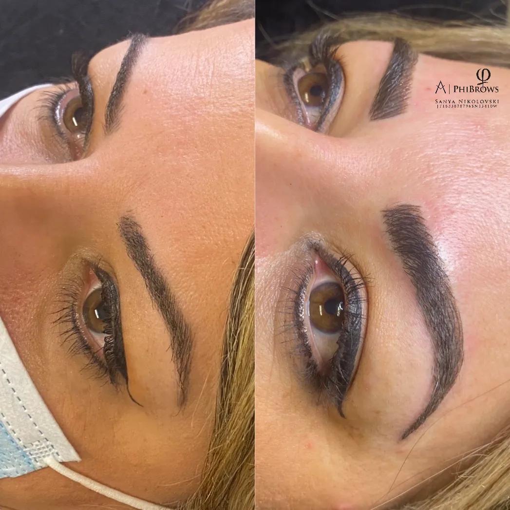 brow-combo-image