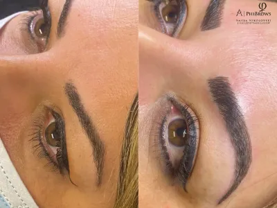 brow-combo-image
