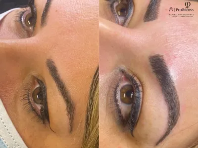 brow-combo-image