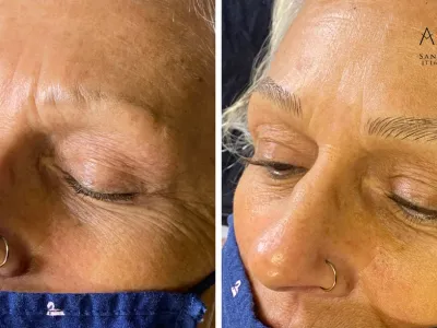 brow-microblading-image