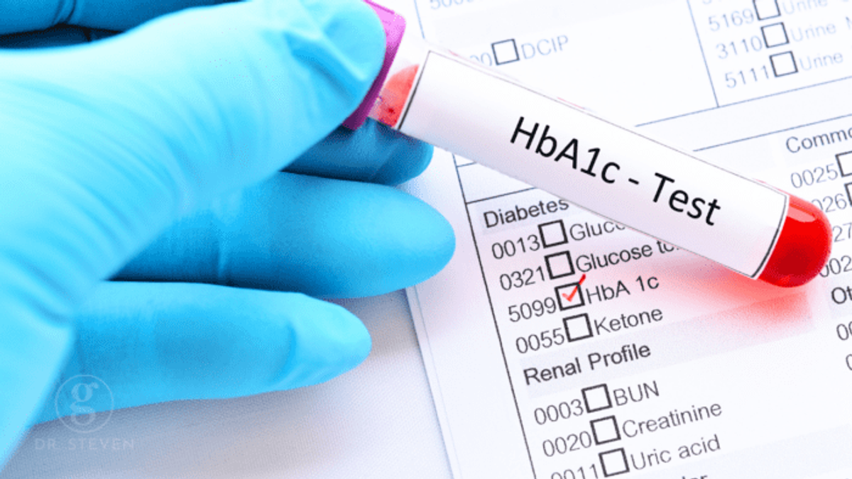 Close-up image of a blood test tube labeled "HbA1c Test" held by a gloved hand, resting on a medical form with "HbA1c" checked off.